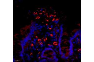 Immunofluorescence (Paraffin-embedded Sections) (IF (p)) image for anti-Tumor Necrosis Factor Receptor Superfamily, Member 6b, Decoy (TNFRSF6B) antibody (ABIN7076071)