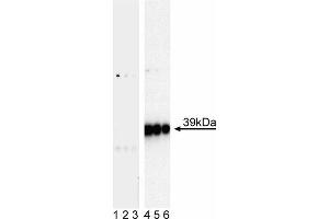 Western blot analysis of c-Jun (pS63) in human vascular endothelium. (C-JUN 抗体  (pSer63))