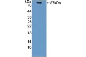 Detection of Recombinant PCSK9, Mouse using Polyclonal Antibody to Proprotein Convertase Subtilisin/Kexin Type 9 (PCSK9)