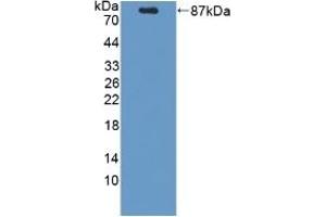 Detection of Recombinant PCSK9, Mouse using Polyclonal Antibody to Proprotein Convertase Subtilisin/Kexin Type 9 (PCSK9) (PCSK9 抗体  (AA 156-694))