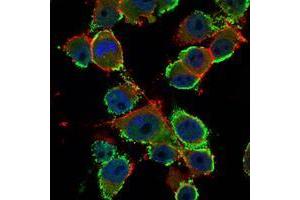 Immunofluorescence analysis of PANC-1 cells using CEA mouse mAb (green). (CEA 抗体)