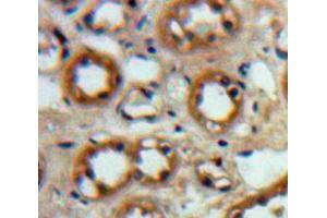 Used in DAB staining on fromalin fixed paraffin-embedded Kidney tissue (IGF1R 抗体  (AA 763-955))