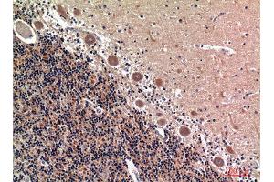 Immunohistochemistry (IHC) analysis of paraffin-embedded Human Brain, antibody was diluted at 1:100. (RSAD2 抗体  (Internal Region))