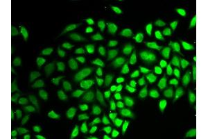 Immunofluorescence analysis of HeLa cell using USP7 antibody. (USP7 抗体  (AA 206-1102))