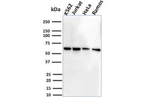 Western Blot Analysis of Human K562, Jurkat, HeLa and Ramos cell lysate using CD127 Mouse Monoclonal Antibody (IL7R/2751). (IL7R 抗体  (AA 21-236))