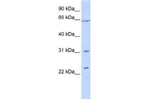 WB Suggested Anti-EME1 Antibody Titration: 0. (Crossover junction endonuclease EME1 (EME1) (N-Term) 抗体)