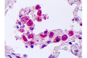 Anti-TNFSF10 / TRAIL antibody IHC of human lung, macrophages.