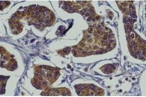 Immunohistochemistry (IHC) image for anti-RAB27A, Member RAS Oncogene Family (RAB27A) (C-Term) antibody (ABIN1440000) (RAB27A 抗体  (C-Term))