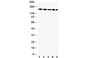 Western blot testing of GLI2 antibody and Lane 1: MCF-7 (GLI2 抗体  (C-Term))