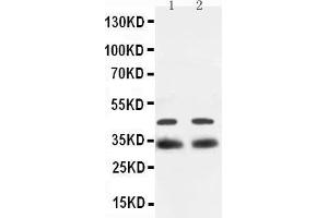 Western Blotting (WB) image for anti-SRY (Sex Determining Region Y)-Box 2 (SOX2) (AA 171-183), (Middle Region) antibody (ABIN3044477) (SOX2 抗体  (Middle Region))