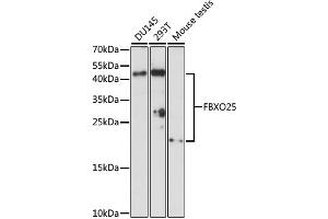 Western blot analysis of extracts of various cell lines, using FBXO25 antibody (ABIN6292075) at 1:1000 dilution. (FBXO25 抗体)