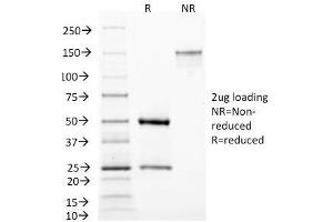 SDS-PAGE Analysis Purified MAML3 Monoclonal Antibody (MAML3/1303). (MAML3 抗体)