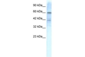 Western Blotting (WB) image for anti-Potassium Voltage-Gated Channel, Shal-Related Subfamily, Member 3 (KCND3) antibody (ABIN2461109) (KCND3 抗体)