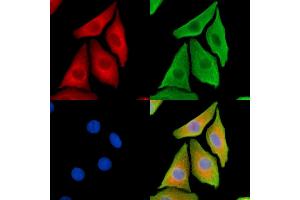 ABIN7095333 and ABIN7099390 staining Hela cells by IF/ICC. (COPA 抗体)