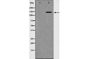 Western blot analysis of Trk B phosphorylation expression in NIH-3T3 whole cell lysates,The lane on the left is treated with the antigen-specific peptide. (TRKB 抗体  (pTyr516))
