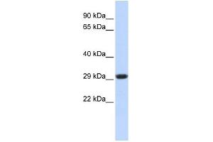 SDHB antibody used at 1 ug/ml to detect target protein. (SDHB 抗体)