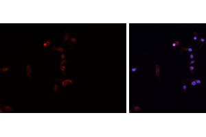 ABIN6276729 staining HEPG2 cells by IF/ICC. (Tryptophan Hydroxylase 1 抗体  (Internal Region))