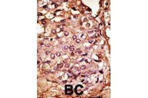 Immunohistochemistry (IHC) image for anti-Chemokine Binding Protein 2 (CCBP2) antibody (ABIN3001323) (CCBP2 抗体)