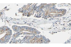 ABIN6275020 at 1/100 staining Human prostate tissue by IHC-P. (CLASP1 抗体  (Internal Region))