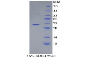SDS-PAGE analysis of Human Interleukin 17C Protein. (IL17C 蛋白)