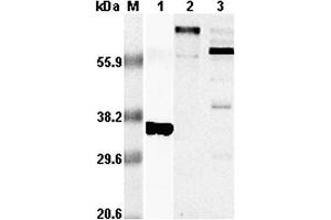 Western blot analysis using anti-RANKL (human), pAb  at 1:5,000 dilution. (RANKL 抗体)