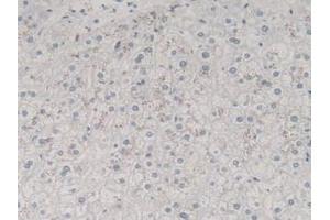 Figure. (TGFB3 抗体  (AA 24-300))