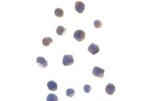 Immunofluorescence (IF) image for anti-Checkpoint Kinase 2 (CHEK2) (N-Term) antibody (ABIN499619)