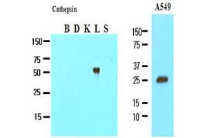 Western Blotting (WB) image for anti-Cathepsin L1 (CTSL1) (AA 114-333) antibody (ABIN317508) (Cathepsin L 抗体  (AA 114-333))