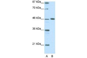 WB Suggested Anti-ZNF259  Antibody Titration: 0. (ZNF259 抗体  (C-Term))