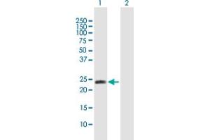 Western Blot analysis of METTL11A expression in transfected 293T cell line by METTL11A MaxPab polyclonal antibody. (METTL11A 抗体  (AA 1-223))