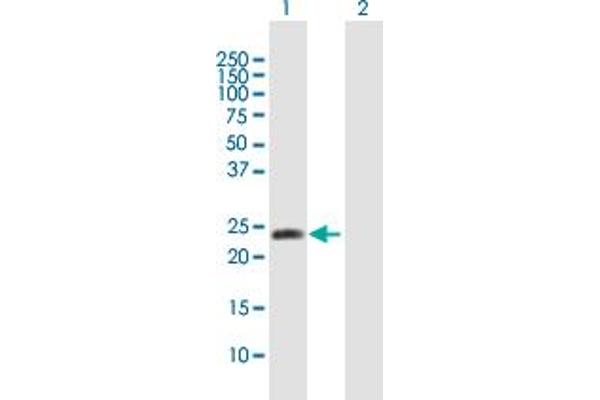 METTL11A 抗体  (AA 1-223)