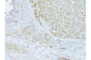 Immunohistochemistry of paraffin-embedded mouse ovary using OCLN antibody (ABIN6003517) at dilution of 1/100 (40x lens). (Occludin 抗体)