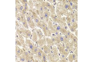 Immunohistochemistry of paraffin-embedded human liver injury using TXNL1 antibody (ABIN5973739) at dilution of 1/100 (40x lens). (TXNL1 抗体)