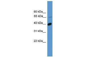 WB Suggested Anti-OR2B2 Antibody Titration: 1. (OR2B2 抗体  (C-Term))