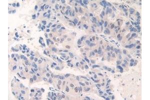 Immunohistochemistry (IHC) image for anti-Centromere Protein I (CENPI) (AA 292-528) antibody (ABIN7442021)