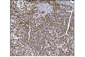 IHC analysis of LRP1B using anti-LRP1B antibody (ABIN7601521). (LRP1B 抗体  (AA 3704-4547))