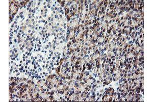 Immunohistochemistry (IHC) image for anti-Platelet/endothelial Cell Adhesion Molecule (PECAM1) antibody (ABIN1497243) (CD31 抗体)