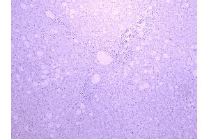 ABIN185606 Negative Control showing staining of paraffin embedded Human Liver, with no primary antibody. (CYP3A4 抗体  (Internal Region))