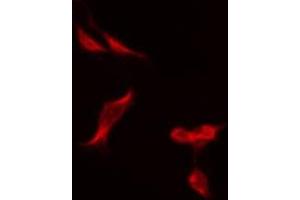ABIN6275483 staining Hela by IF/ICC. (Renin 抗体  (Internal Region))