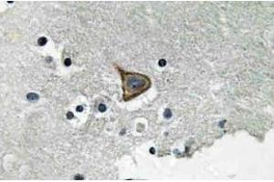 Immunohistochemistry (IHC) analyzes of p-Connexin 43 antibody in paraffin-embedded human brain tissue. (Connexin 43/GJA1 抗体  (pSer367))
