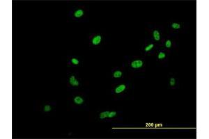 Immunofluorescence of purified MaxPab antibody to SAFB2 on HeLa cell. (SAFB2 抗体  (AA 1-528))