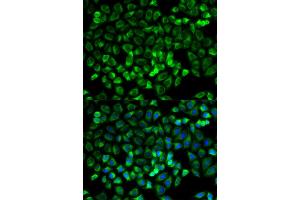 Immunofluorescence analysis of HeLa cells using TPSAB1 antibody. (TPSAB1 抗体)