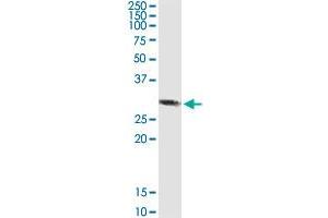 RBKS MaxPab rabbit polyclonal antibody. (Ribokinase 抗体  (AA 1-322))