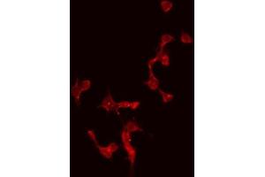 ABIN6274996 staining Hela by IF/ICC. (CBLN4 抗体  (Internal Region))