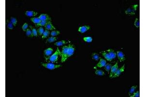 Immunofluorescent analysis of HepG2 cells using ABIN7146050 at dilution of 1:100 and Alexa Fluor 488-congugated AffiniPure Goat Anti-Rabbit IgG(H+L)