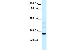 WB Suggested Anti-Snf8 Antibody   Titration: 1. (SNF8 抗体  (N-Term))