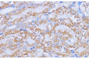 Immunohistochemistry of paraffin-embedded Mouse kidney using NME6 Polyclonal Antibody at dilution of 1:100 (40x lens). (NME6 抗体)