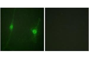 Immunofluorescence (IF) image for anti-serine/threonine Kinase 11 (STK11) (AA 384-433) antibody (ABIN2888735) (LKB1 抗体  (AA 384-433))