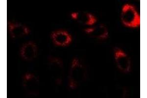 Immunofluorescent analysis of CCT3 staining in U2OS cells. (CCT3 抗体)