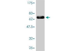 Western Blot detection against Immunogen (67. (TYR 抗体  (AA 1-377))